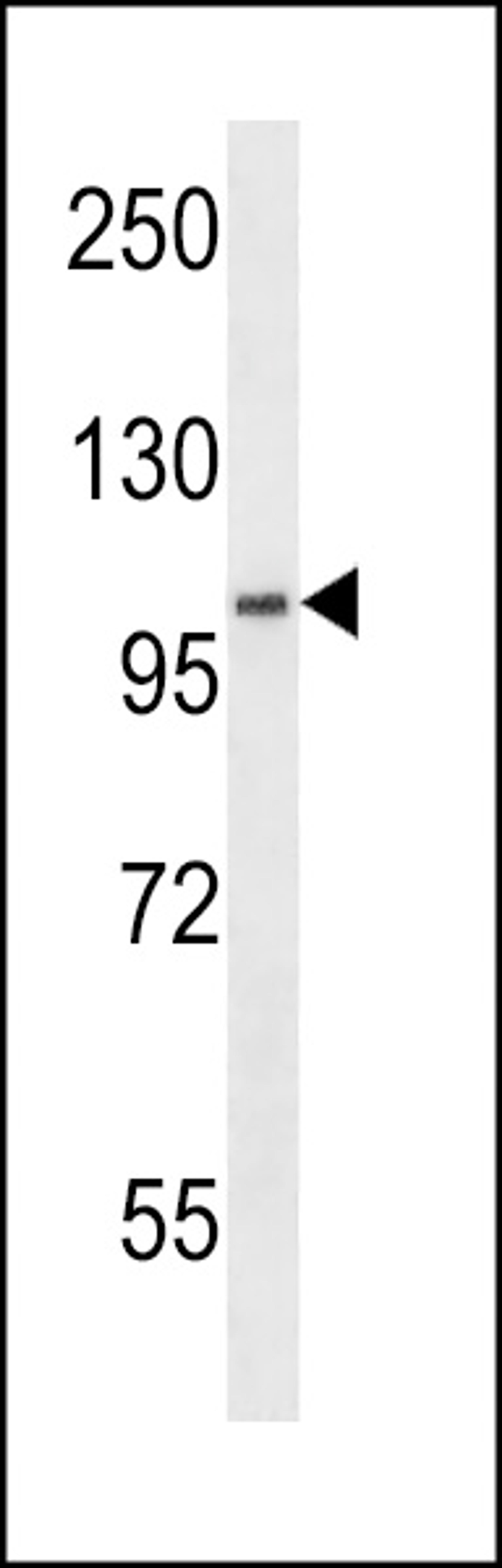 Western blot analysis in WiDr cell line lysates (35ug/lane).