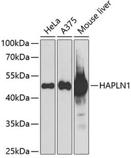 Western blot - HAPLN1 antibody (A6616)