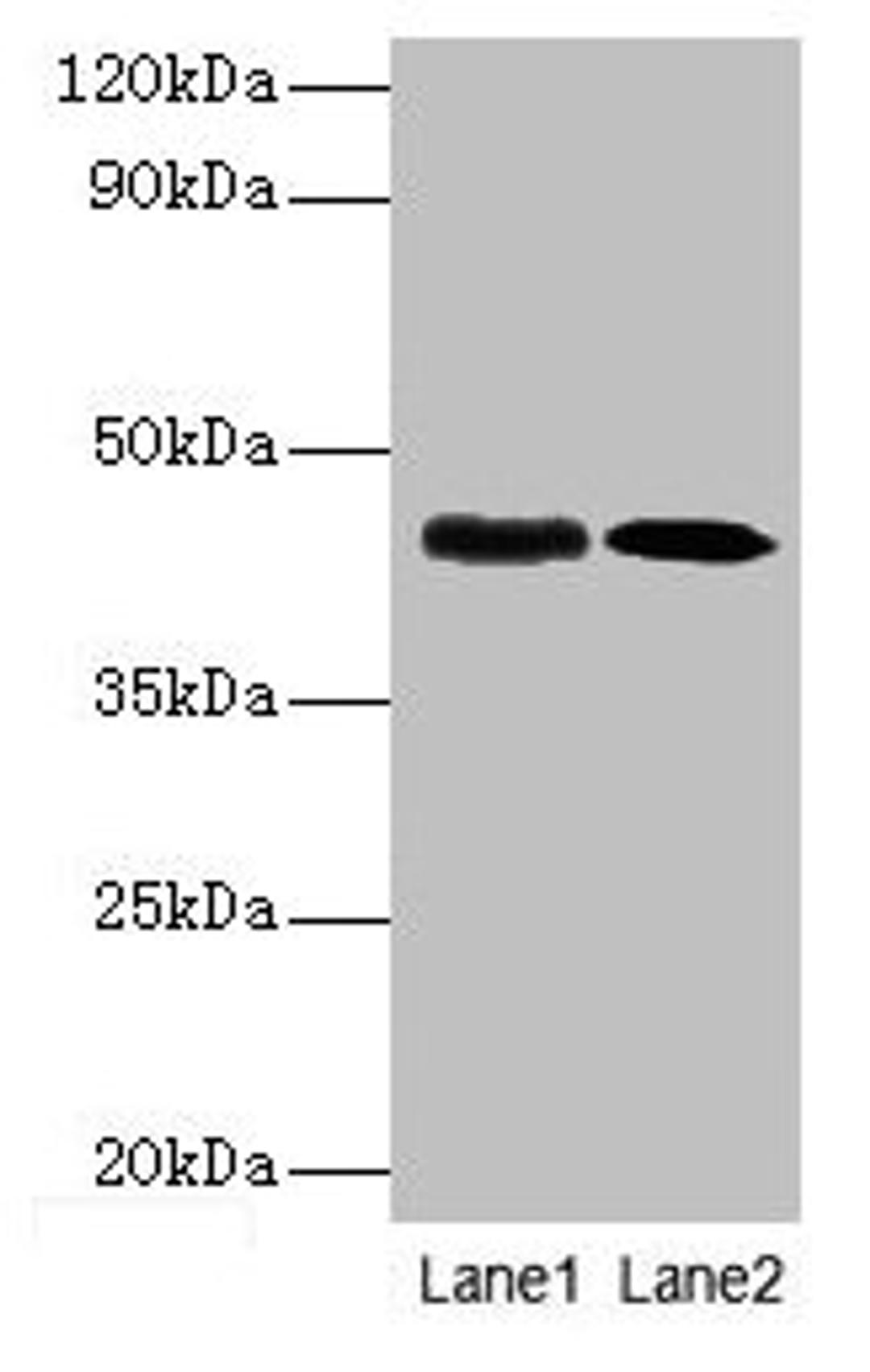 Western blot. All lanes: lapB antibody at 1: 1000. Lane1: DH5α whole cell lysate at 10µg. Lane2: DH5α whole cell lysate at 1µg. Secondary. Goat polyclonal to rabbit IgG at 1/10000 dilution. Predicted band size: 45 kDa. Observed band size: 45 kDa