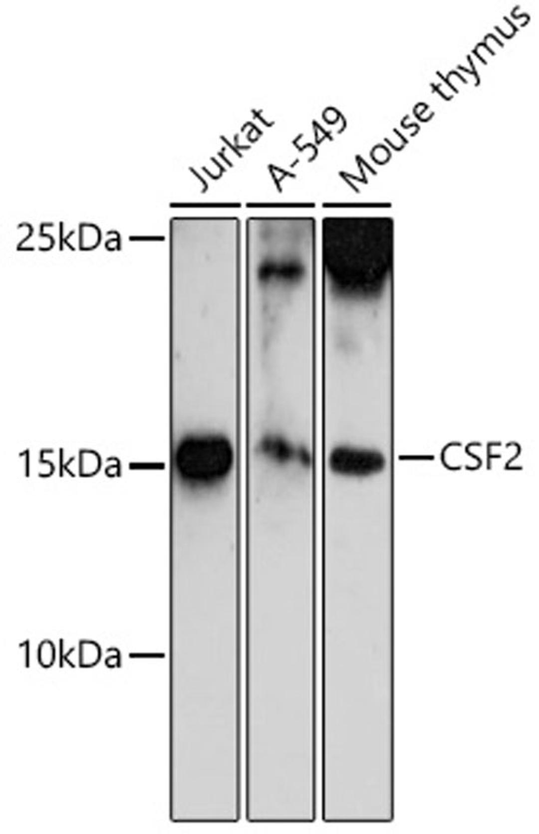 Western blot - CSF2 antibody (A6127)