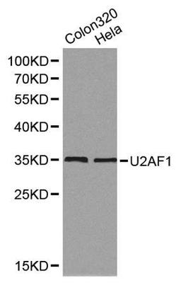 Western blot analysis of Colon320,hela cell line lysates using U2AF1 antibody