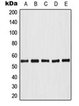 Western blot analysis of HeLa colchicine-treated (Lane 1), HL60 (Lane 2), NIH3T3 (Lane 3), SP2/0 colchicine-treated (Lane 4), PC12 colchicine-treated (Lane 5) whole cell lysates using AKT1 antibody