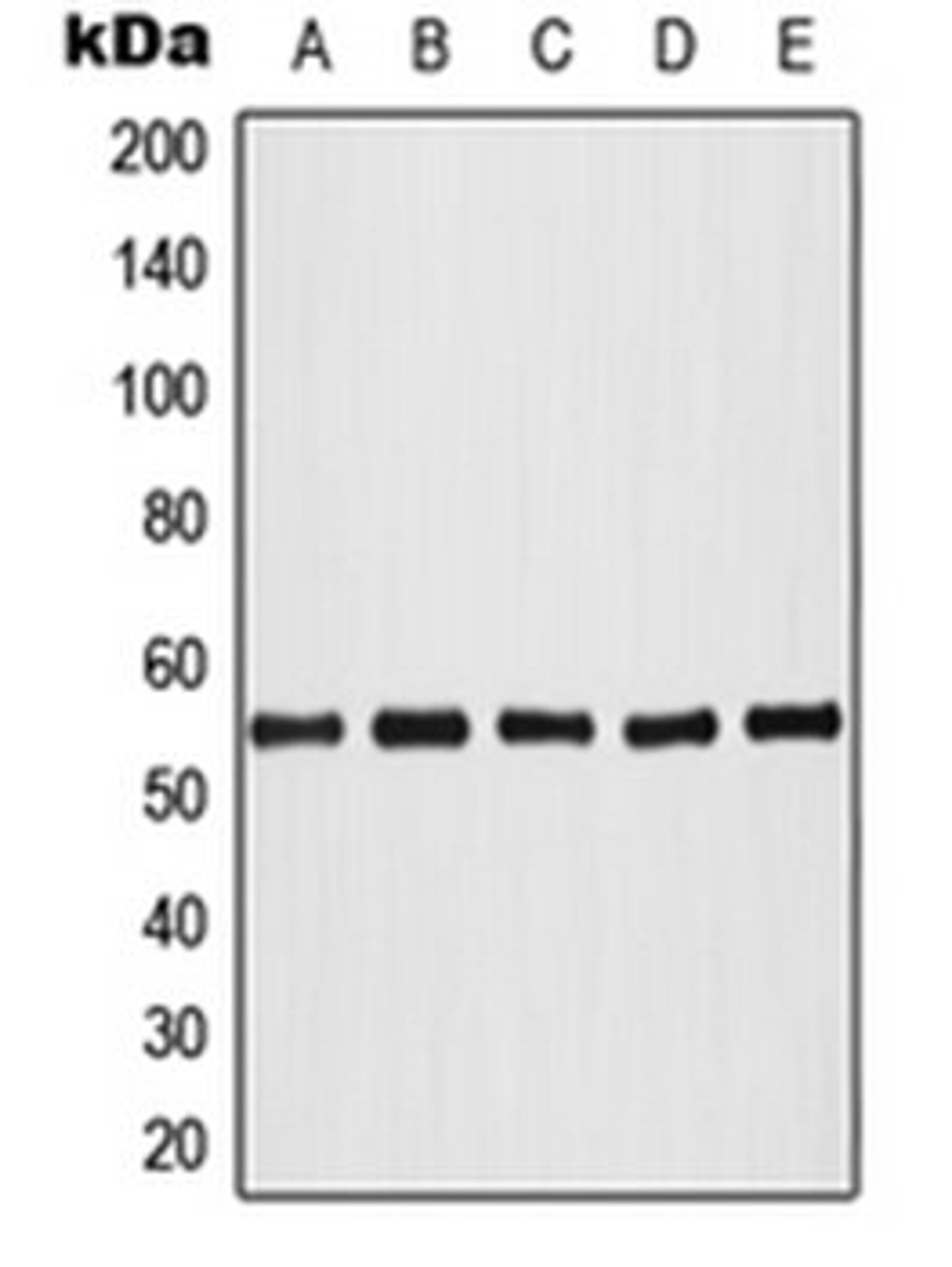 Western blot analysis of HeLa colchicine-treated (Lane 1), HL60 (Lane 2), NIH3T3 (Lane 3), SP2/0 colchicine-treated (Lane 4), PC12 colchicine-treated (Lane 5) whole cell lysates using AKT1 antibody