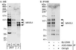 Detection of human NFATc1 by western blot and immunoprecipitation.