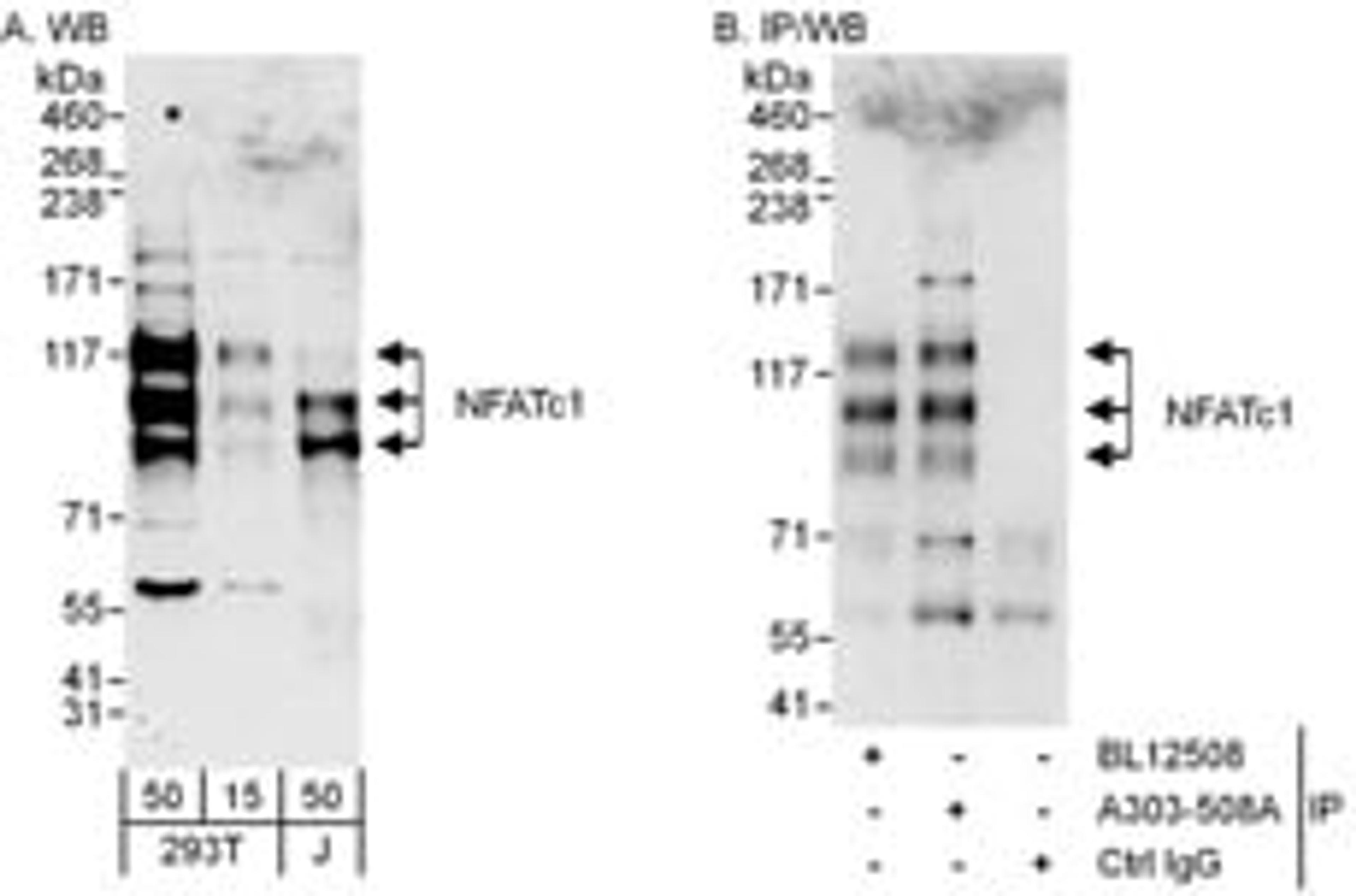 Detection of human NFATc1 by western blot and immunoprecipitation.