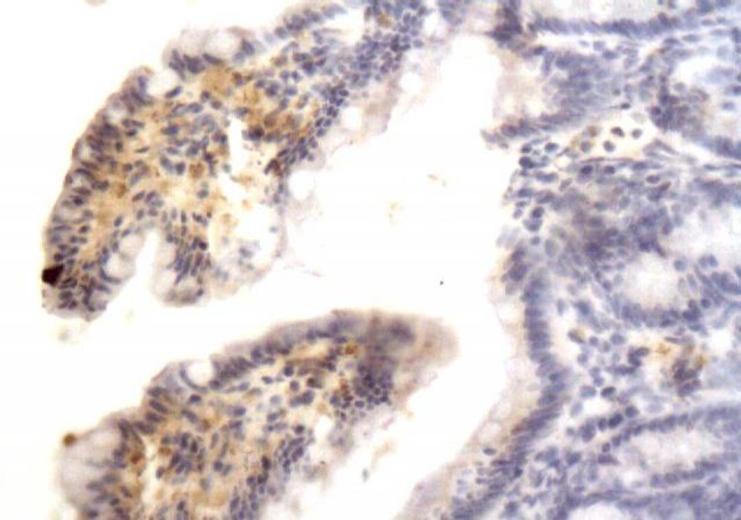 Immunohistochemical analysis of paraffin-embedded rat intestine tissue (affected by ulcer) using Integrin alpha 5 beta 1 antibody