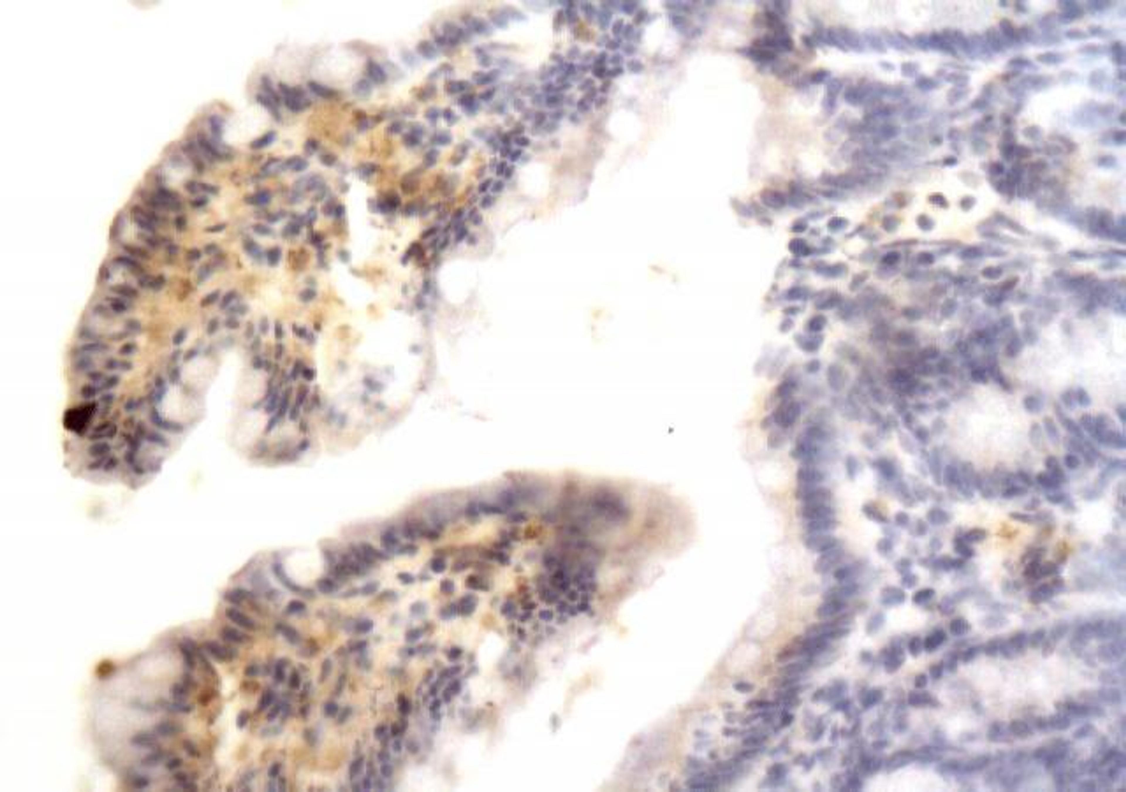 Immunohistochemical analysis of paraffin-embedded rat intestine tissue (affected by ulcer) using Integrin alpha 5 beta 1 antibody