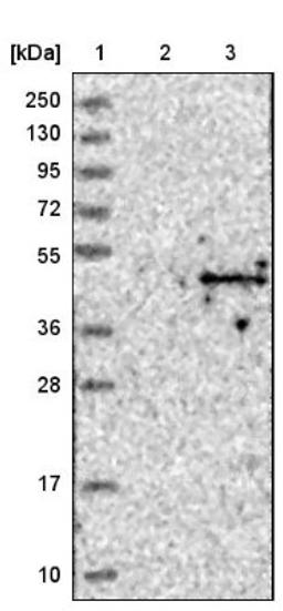 Western Blot: ACTL8 Antibody [NBP1-85398] - Lane 1: Marker [kDa] 250, 130, 95, 72, 55, 36, 28, 17, 10<br/>Lane 2: Negative control (vector only transfected HEK293T lysate)<br/>Lane 3: Over-expression lysate (Co-expressed with a C-terminal myc-DDK tag (~3.1 kDa) in mammalian HEK293T cells, LY403085)