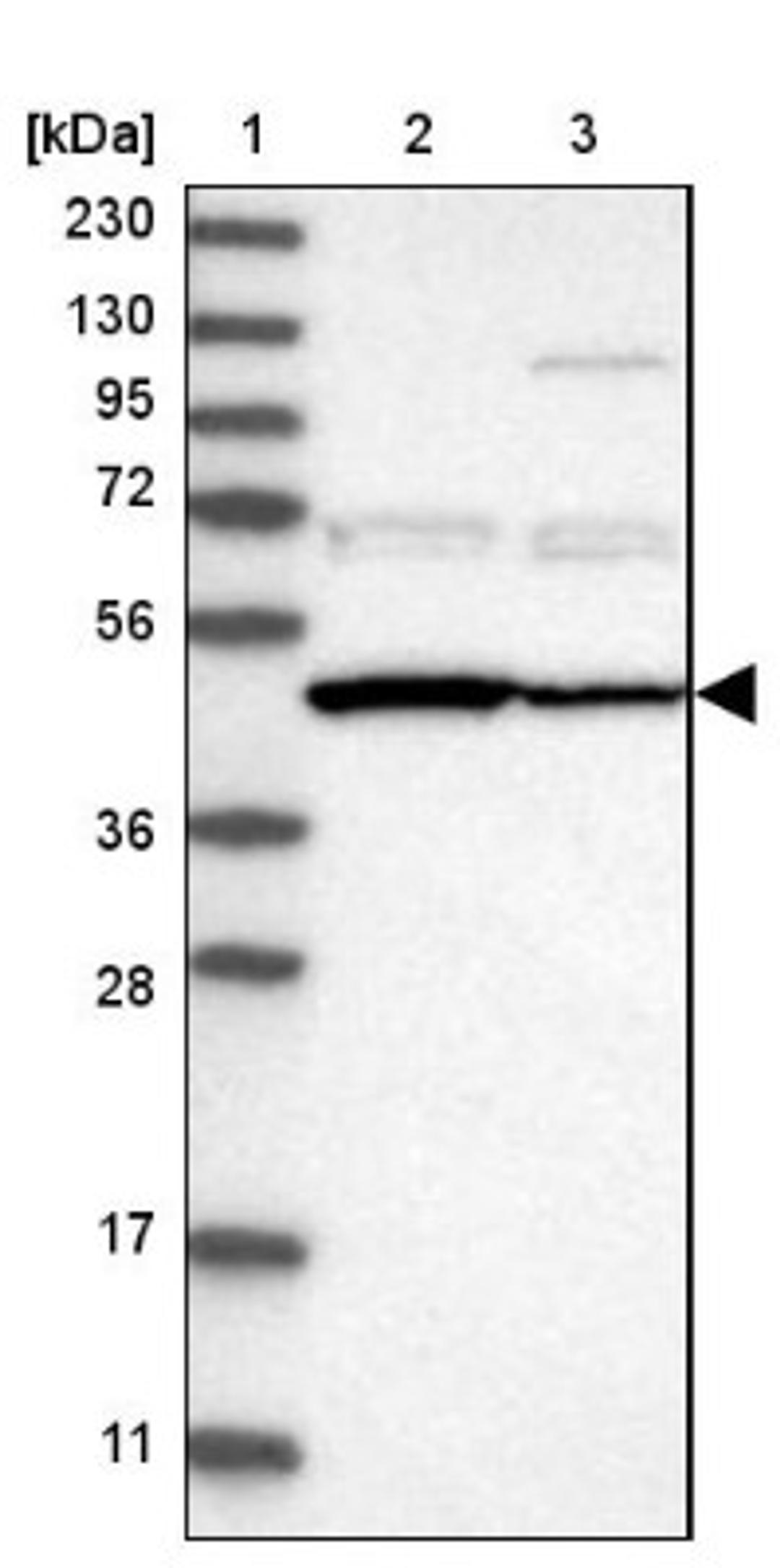 Western Blot: PDP2 Antibody [NBP1-82912] - Lane 1: Marker [kDa] 230, 130, 95, 72, 56, 36, 28, 17, 11<br/>Lane 2: Human cell line RT-4<br/>Lane 3: Human cell line U-251MG sp