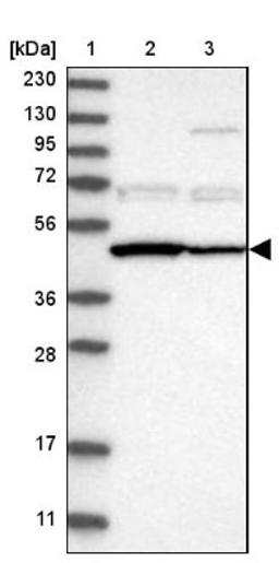 Western Blot: PDP2 Antibody [NBP1-82912] - Lane 1: Marker [kDa] 230, 130, 95, 72, 56, 36, 28, 17, 11<br/>Lane 2: Human cell line RT-4<br/>Lane 3: Human cell line U-251MG sp