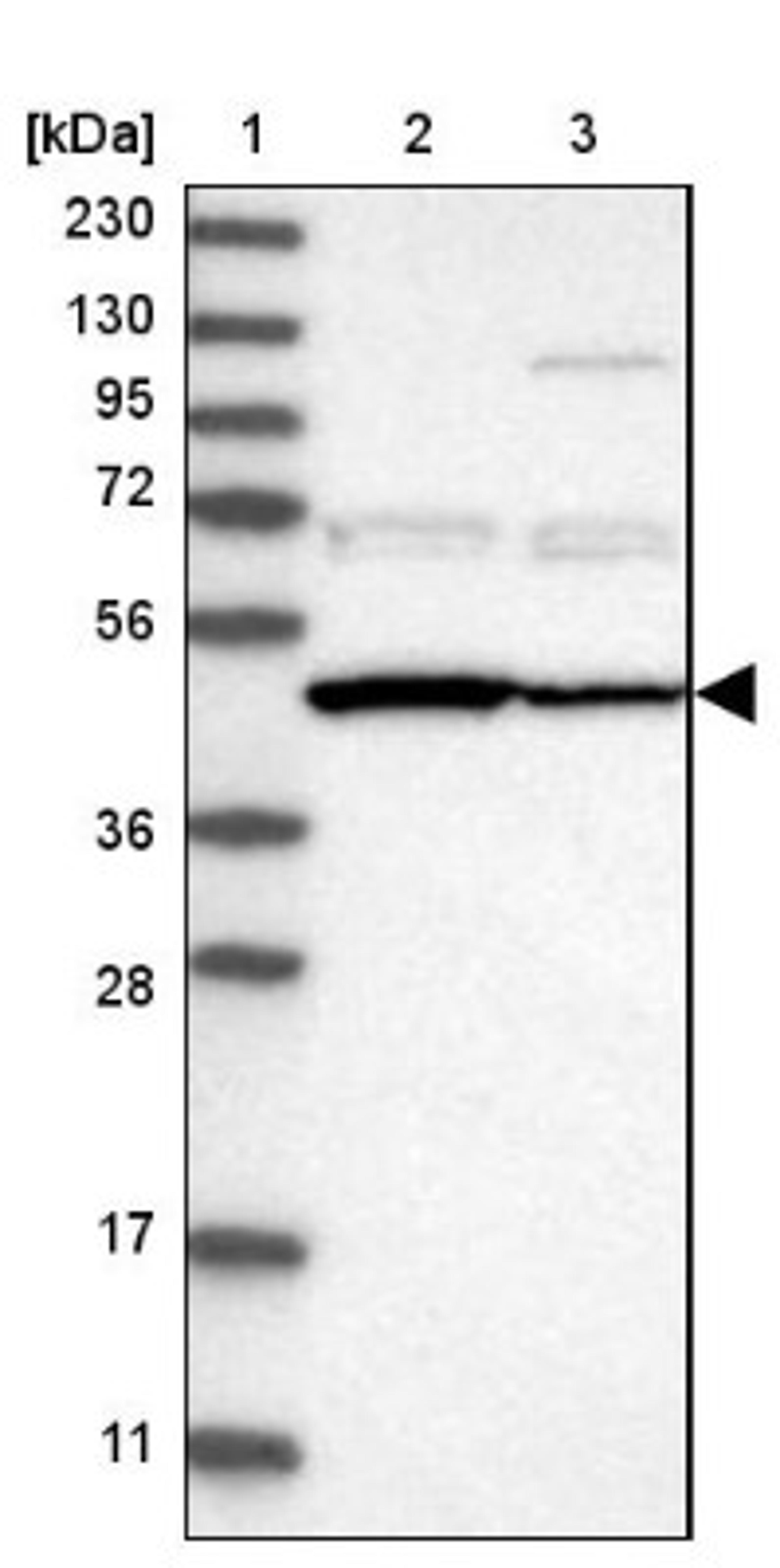 Western Blot: PDP2 Antibody [NBP1-82912] - Lane 1: Marker [kDa] 230, 130, 95, 72, 56, 36, 28, 17, 11<br/>Lane 2: Human cell line RT-4<br/>Lane 3: Human cell line U-251MG sp