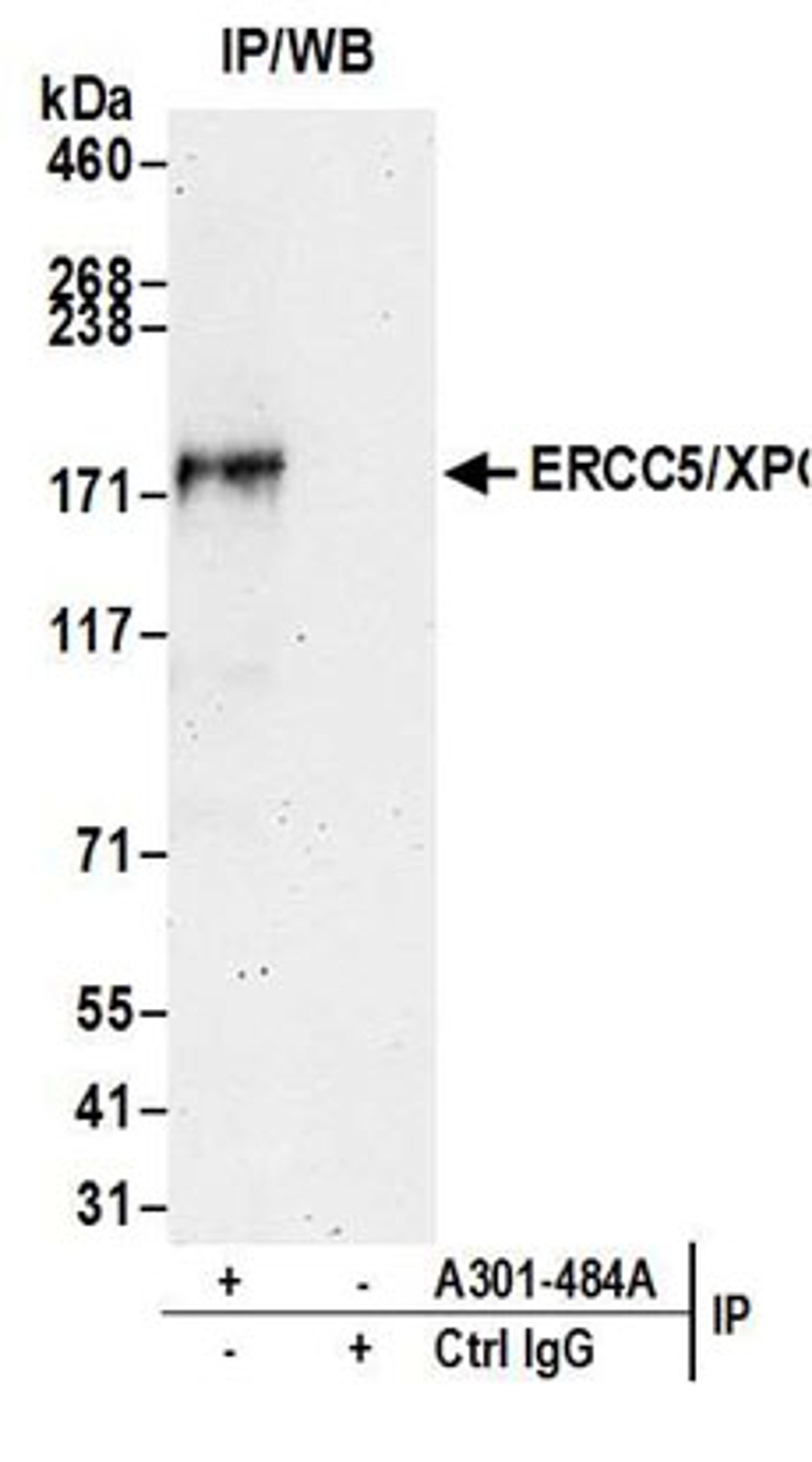 Detection of human ERCC5/XPG by western blot of immunoprecipitates.