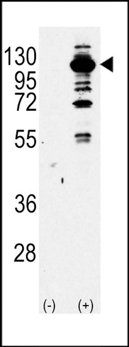 Western blot analysis of PI3KCG Antibody Pab using purified Pab using 293 cell lysates (2 ug/lane) either nontransfected (Lane 1) or transiently transfected with the PI3KCG gene (Lane 2).