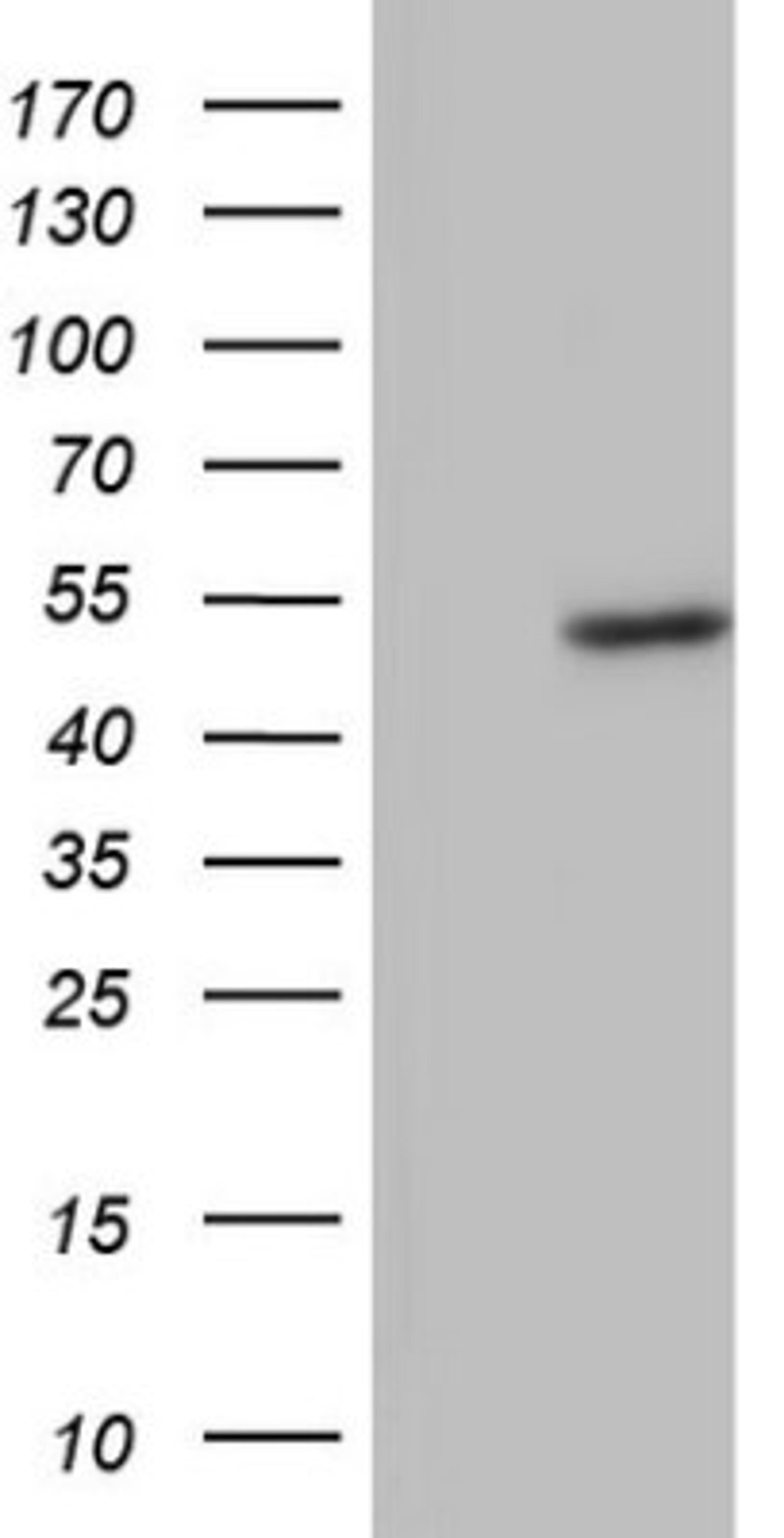 Western Blot: phakinin Antibody (4E7) [NBP2-46573] - Analysis of HEK293T cells were transfected with the pCMV6-ENTRY control (Left lane) or pCMV6-ENTRY Phakinin.