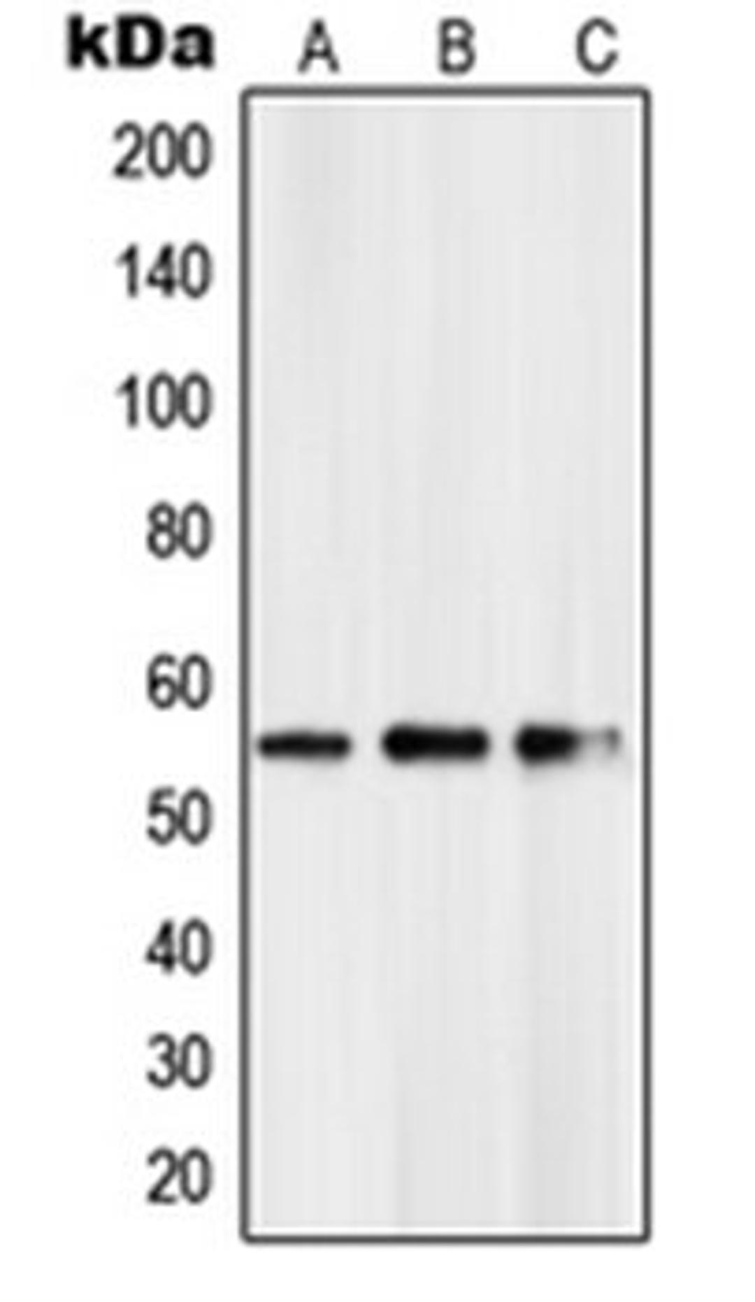 Western blot analysis of HeLa (Lane 1), mouse kidney (Lane 2), rat kidney (Lane 3) whole cell lysates using PKNOX2 antibody