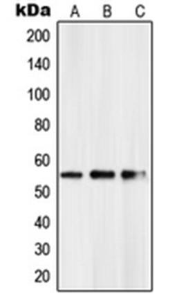 Western blot analysis of HeLa (Lane 1), mouse kidney (Lane 2), rat kidney (Lane 3) whole cell lysates using PKNOX2 antibody