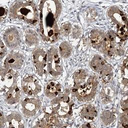 Immunohistochemistry: SBEM Antibody [NBP1-92366] - Staining of human breast shows moderate cytoplasmic and extracellular positivity in glandular cells.