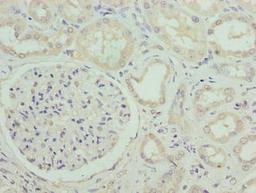 Immunohistochemistry of paraffin-embedded human kidney tissue using CSB-PA835675LA01HU at dilution of 1:100