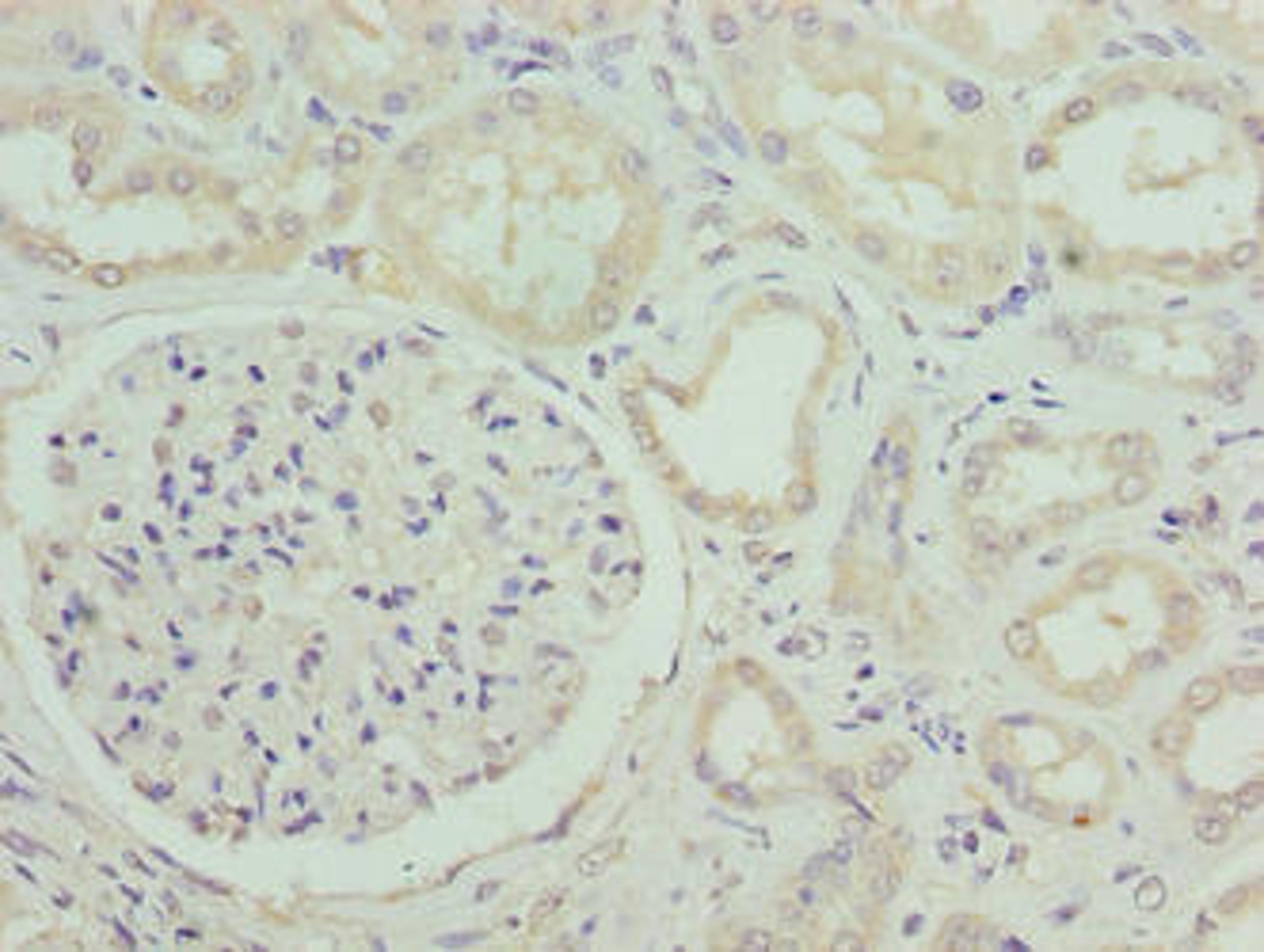 Immunohistochemistry of paraffin-embedded human kidney tissue using CSB-PA835675LA01HU at dilution of 1:100