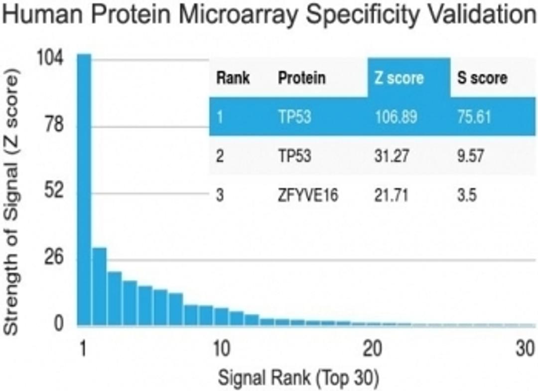 Analysis of HuProt(TM) microarray containing more than 19,000 full-length human proteins using recombinant p53 antibody (clone TP53/1799R).  Z- and S- score: The Z-score represents the strength of a signal that an antibody (in combination with a fluoresce