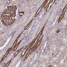 Immunohistochemistry-Paraffin: MPRA Antibody [NBP2-13731] - Staining of human kidney shows strong cytoplasmic positivity in distal tubules and cells in glomeruli.