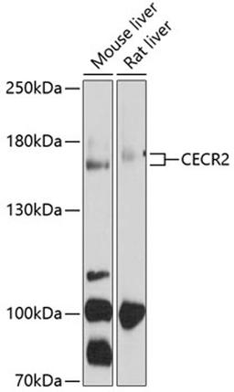 Western blot - CECR2 antibody (A10143)