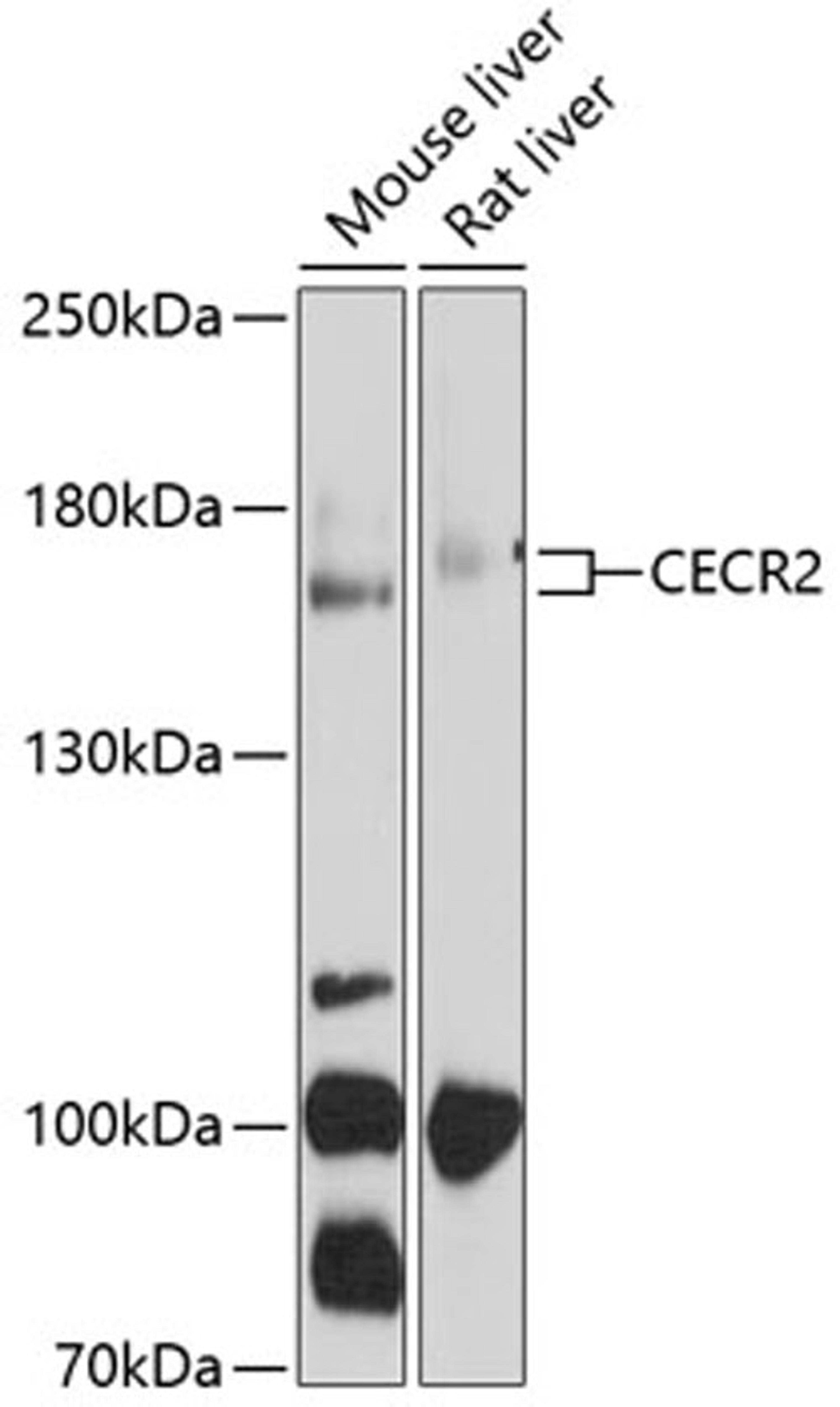 Western blot - CECR2 antibody (A10143)