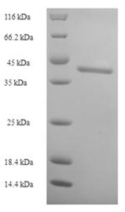 (Tris-Glycine gel) Discontinuous SDS-PAGE (reduced) with 5% enrichment gel and 15% separation gel.