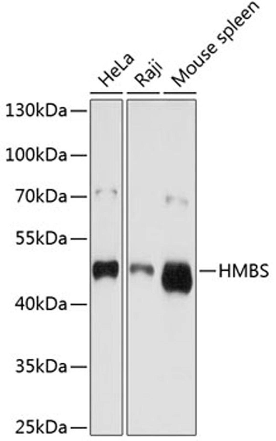 Western blot - HMBS antibody (A1777)