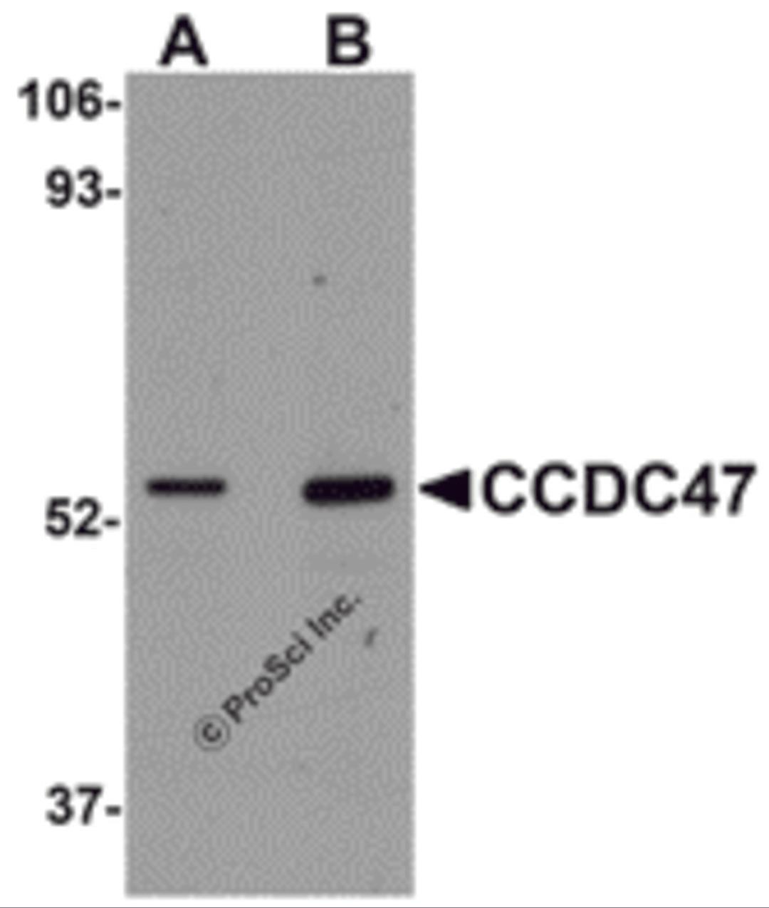 Western blot analysis of CCDC47 in mouse heart tissue lysate with CCDC47 antibody at (A) 1 and (B) 2 &#956;g/mL.