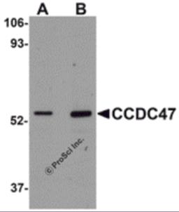 Western blot analysis of CCDC47 in mouse heart tissue lysate with CCDC47 antibody at (A) 1 and (B) 2 &#956;g/mL.