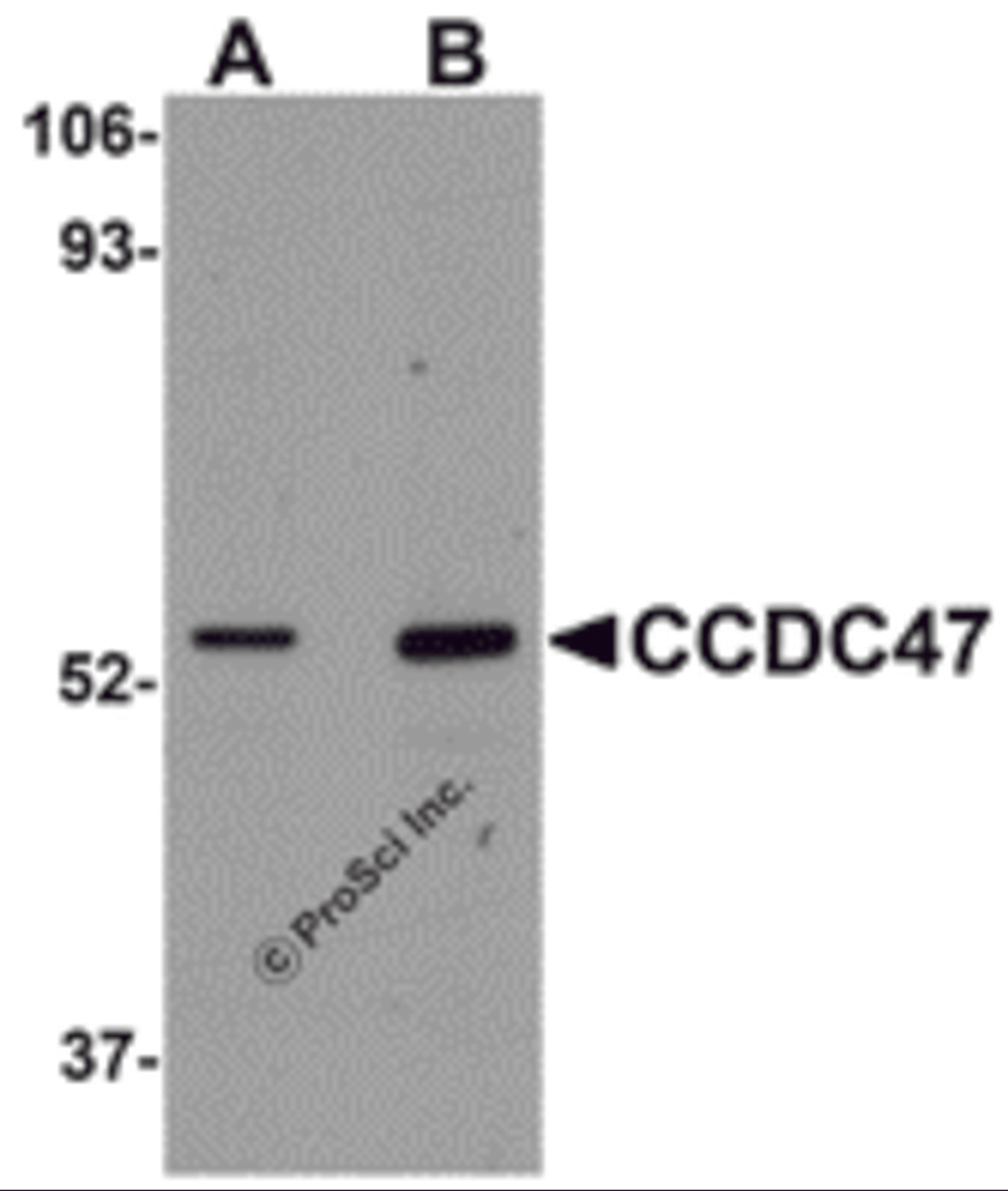 Western blot analysis of CCDC47 in mouse heart tissue lysate with CCDC47 antibody at (A) 1 and (B) 2 &#956;g/mL.