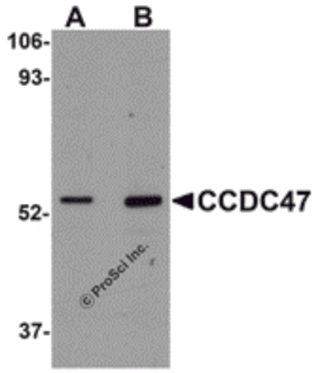Western blot analysis of CCDC47 in mouse heart tissue lysate with CCDC47 antibody at (A) 1 and (B) 2 μg/mL.