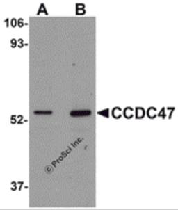 Western blot analysis of CCDC47 in mouse heart tissue lysate with CCDC47 antibody at (A) 1 and (B) 2 μg/mL.