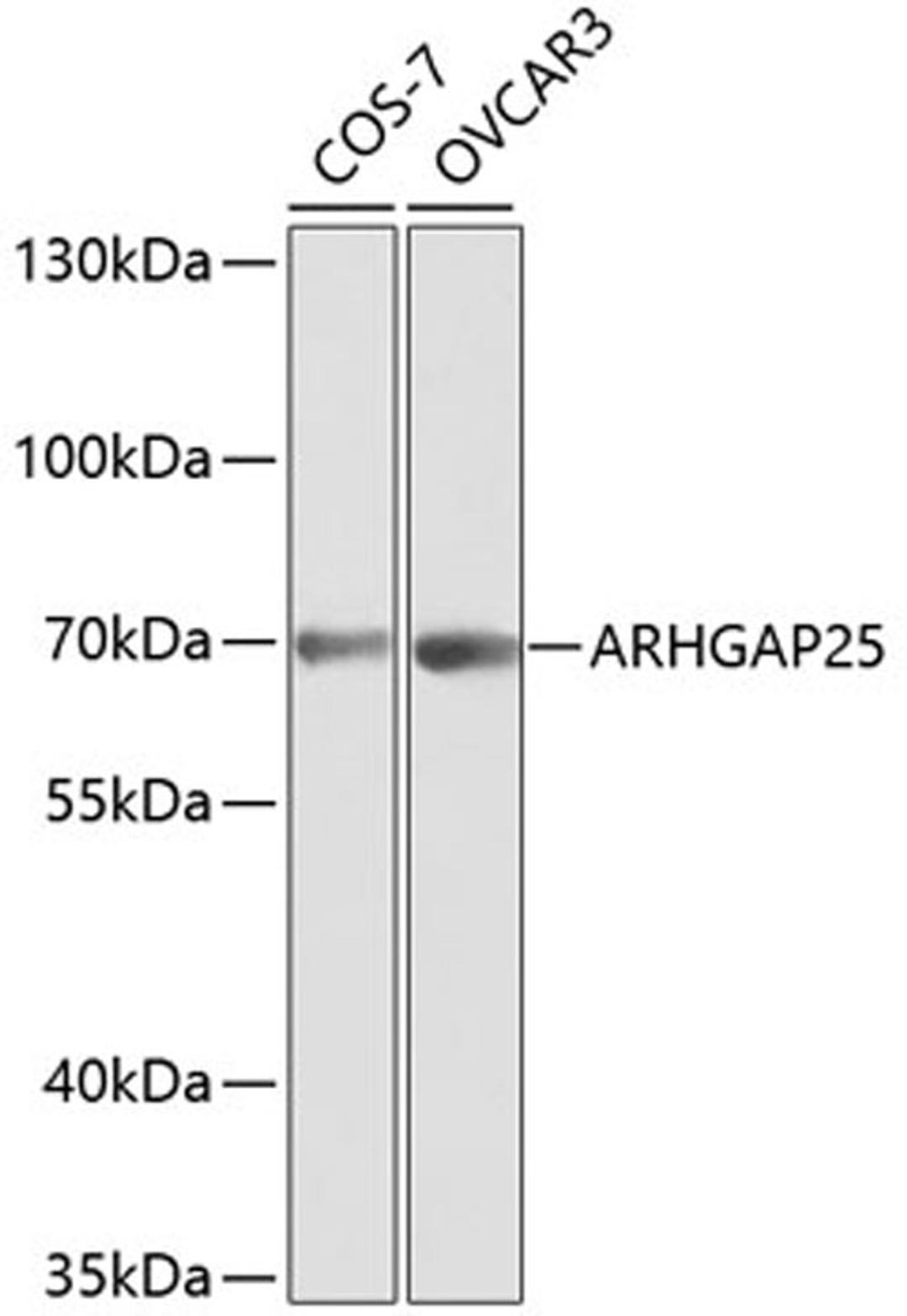 Western blot - ARHGAP25 antibody (A1223)