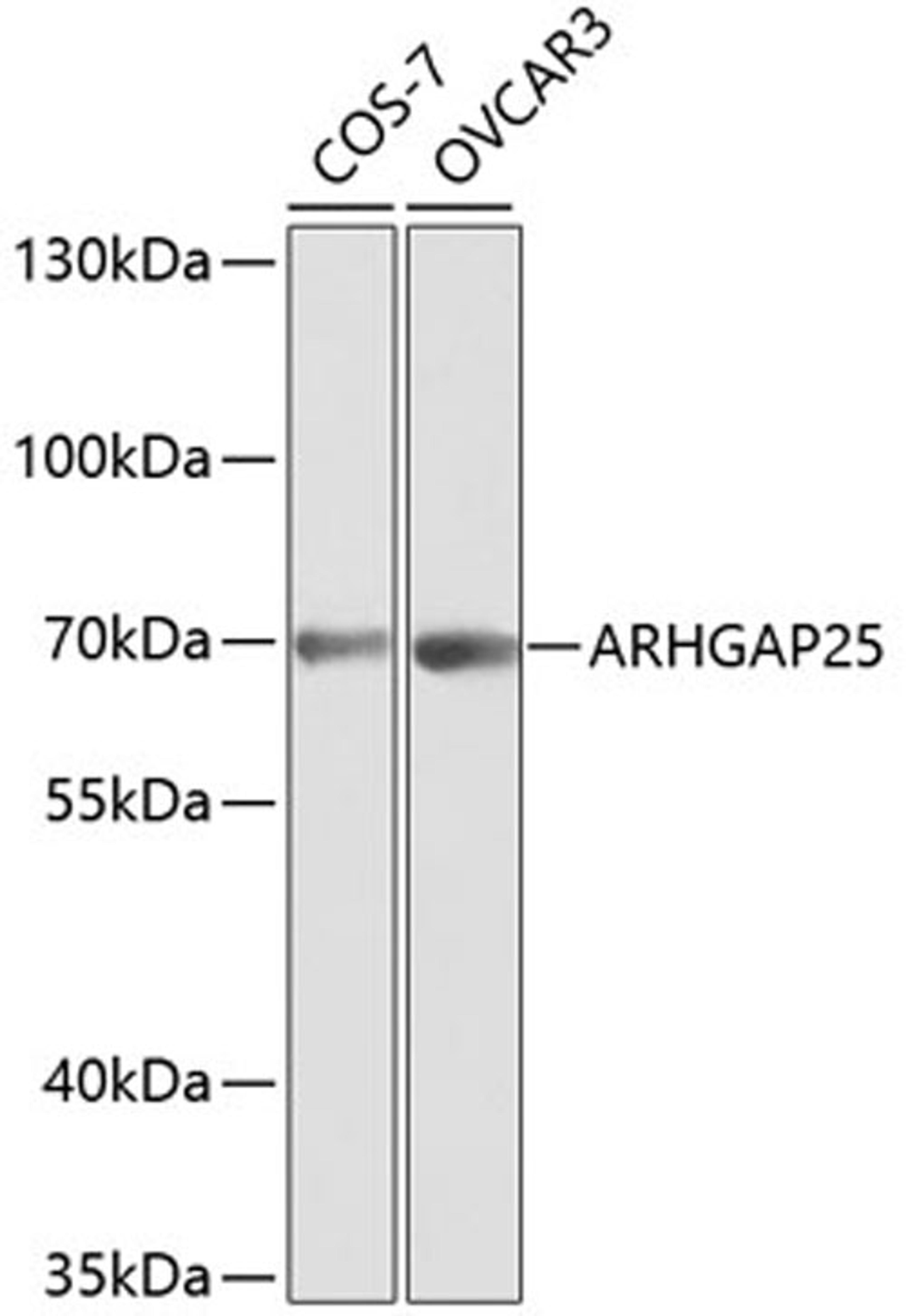 Western blot - ARHGAP25 antibody (A1223)