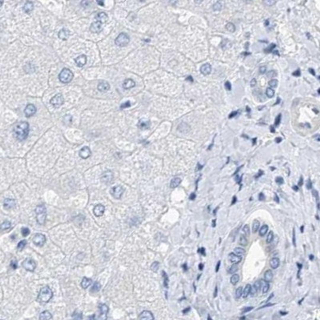 Immunohistochemistry: RCN2 Antibody [NBP2-32011] - liver