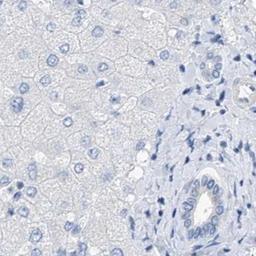 Immunohistochemistry: RCN2 Antibody [NBP2-32011] - liver