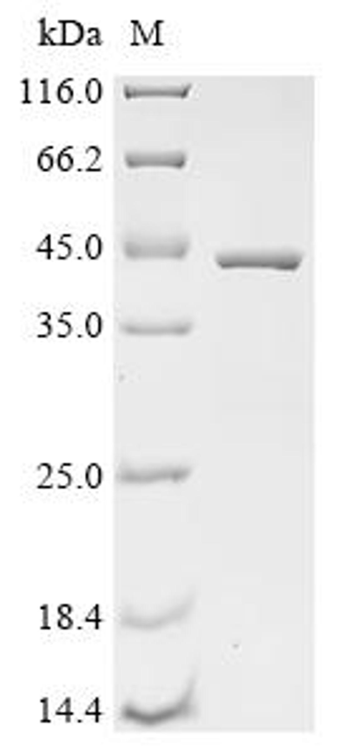 (Tris-Glycine gel) Discontinuous SDS-PAGE (reduced) with 5% enrichment gel and 15% separation gel.