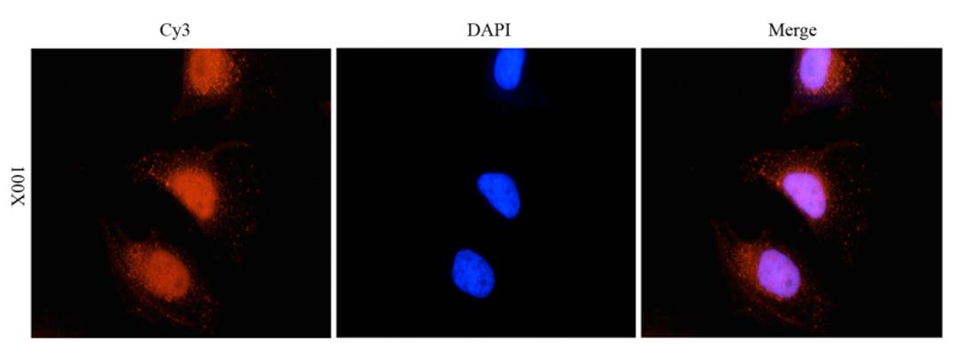 Immunofluorescence analysis of human hela cells tissue using RANTES antibody (5 ug/ml)