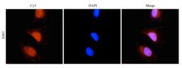 Immunofluorescence analysis of human hela cells tissue using RANTES antibody (5 ug/ml)
