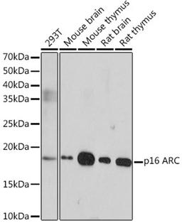 Western blot - p16 ARC Rabbit mAb (A4794)