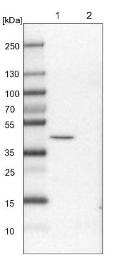 Western Blot: PRDM12 Antibody [NBP1-85829] - Lane 1: Mouse liver tissue lysate<br/>Lane 2: Rat liver tissue lysate