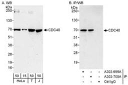 Detection of human CDC40 by western blot and immunoprecipitation.