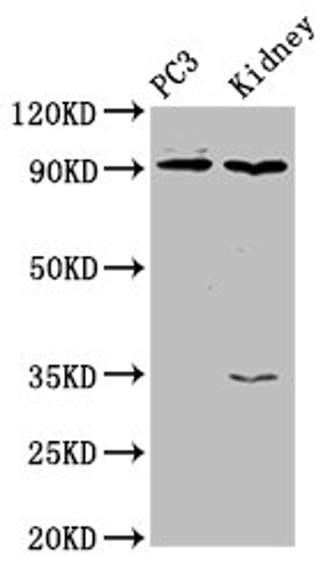Western Blot. Positive WB detected in: PC-3 whole cell lysate, Rat kidney tissue. All lanes: CDK11A antibody at 4µg/ml. Secondary. Goat polyclonal to rabbit IgG at 1/50000 dilution. Predicted band size: 92, 91, 46, 19, 63, 50 kDa. Observed band size: 92 kDa