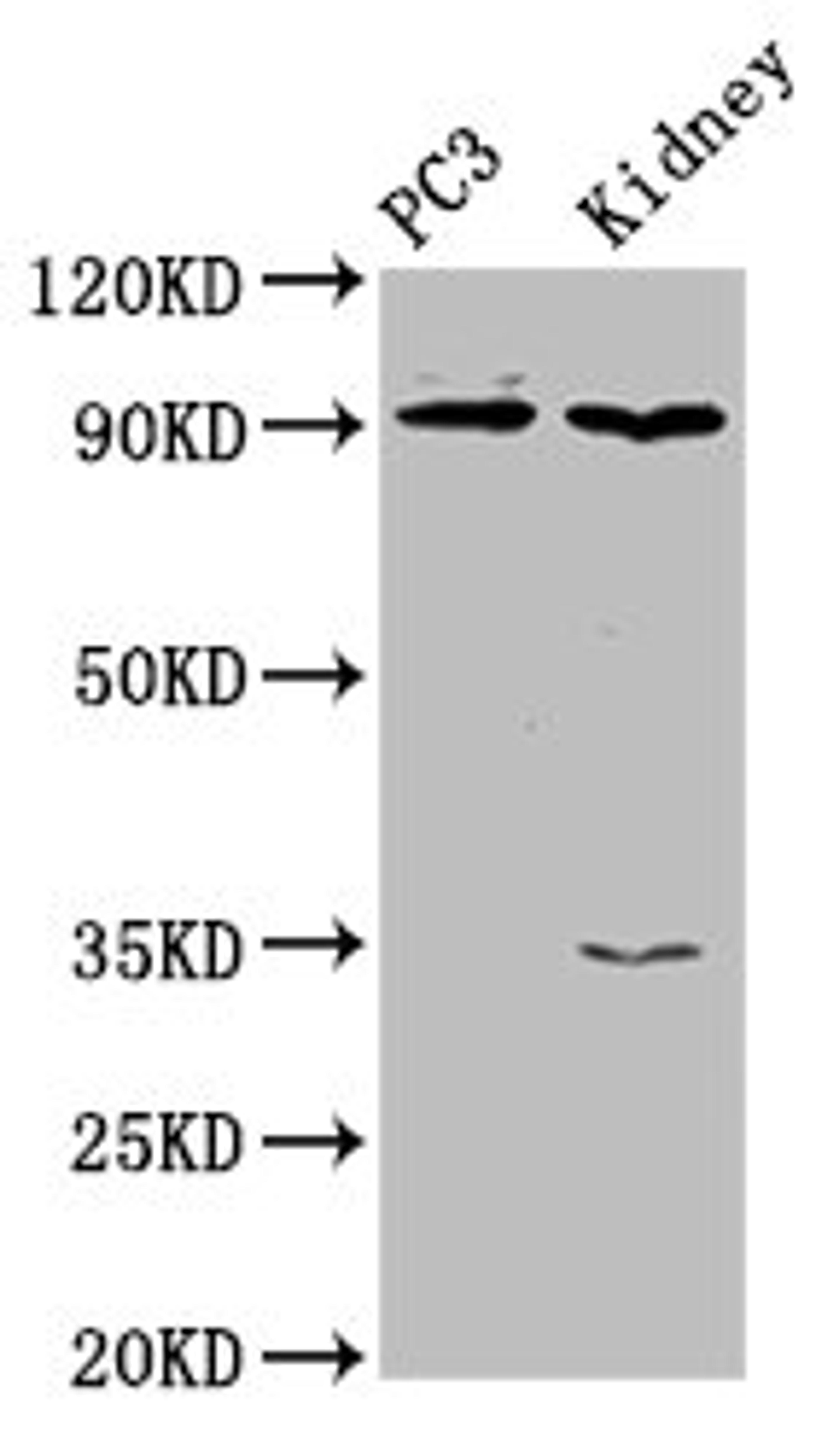 Western Blot. Positive WB detected in: PC-3 whole cell lysate, Rat kidney tissue. All lanes: CDK11A antibody at 4µg/ml. Secondary. Goat polyclonal to rabbit IgG at 1/50000 dilution. Predicted band size: 92, 91, 46, 19, 63, 50 kDa. Observed band size: 92 kDa