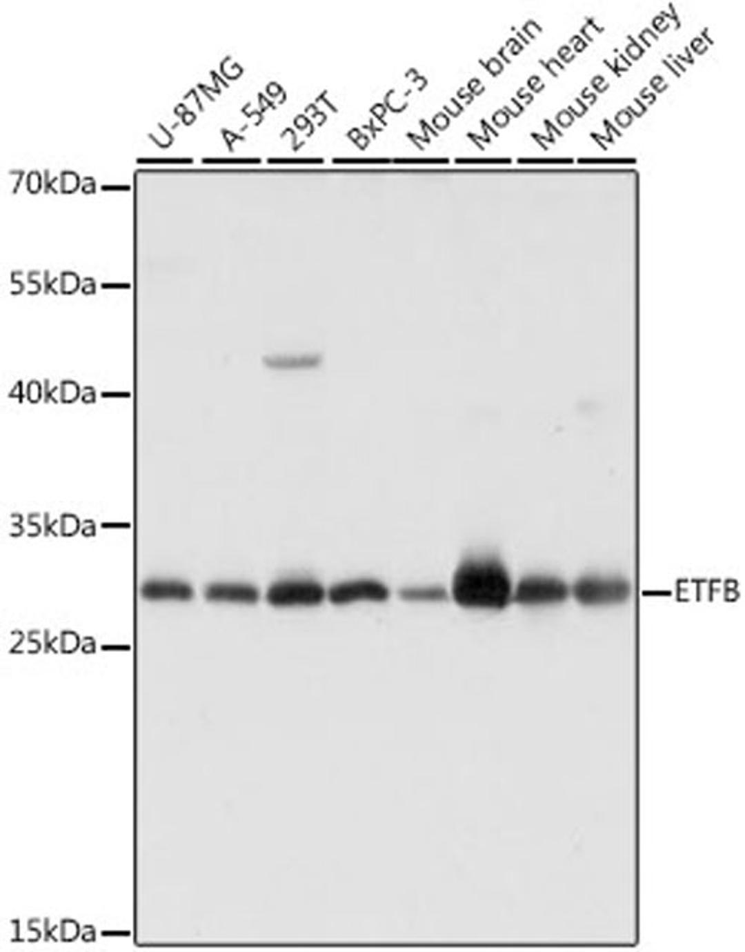 Western blot - ETFB antibody (A16043)