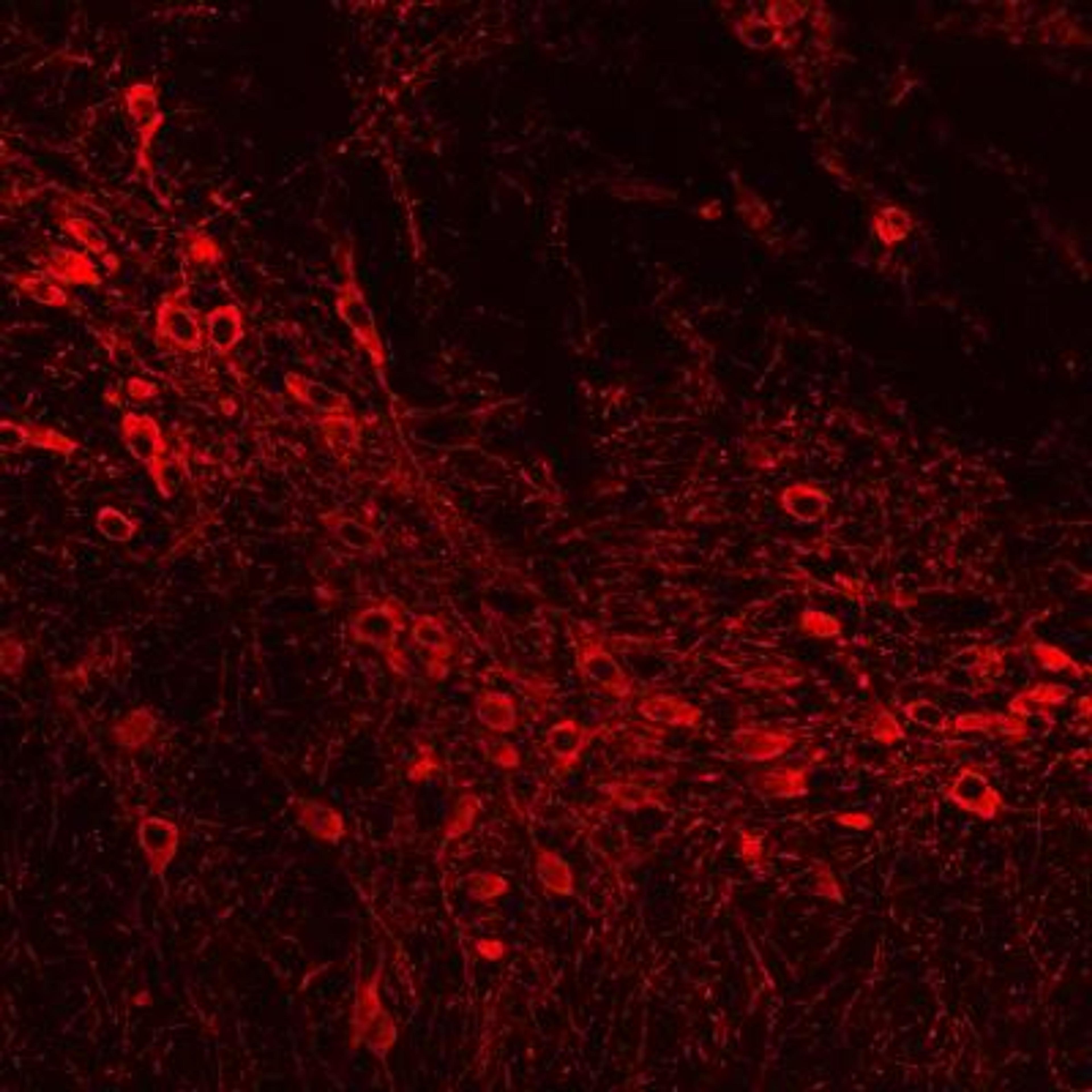 Immunocytochemistry/Immunofluorescence: Tyrosine Hydroxylase Antibody [NB300-110] - Analysis of gelatin section of mouse brain (substantia nigra pars compacta) using Tyrosine Hydroxylase antibody. Image from verified customer review.