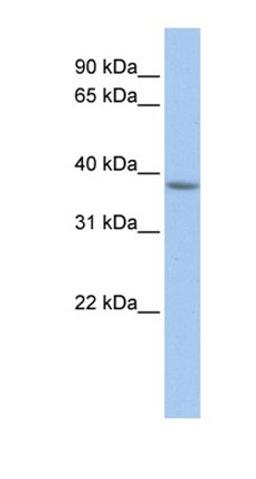 Western blot analysis of human Muscle tissue using MFF antibody