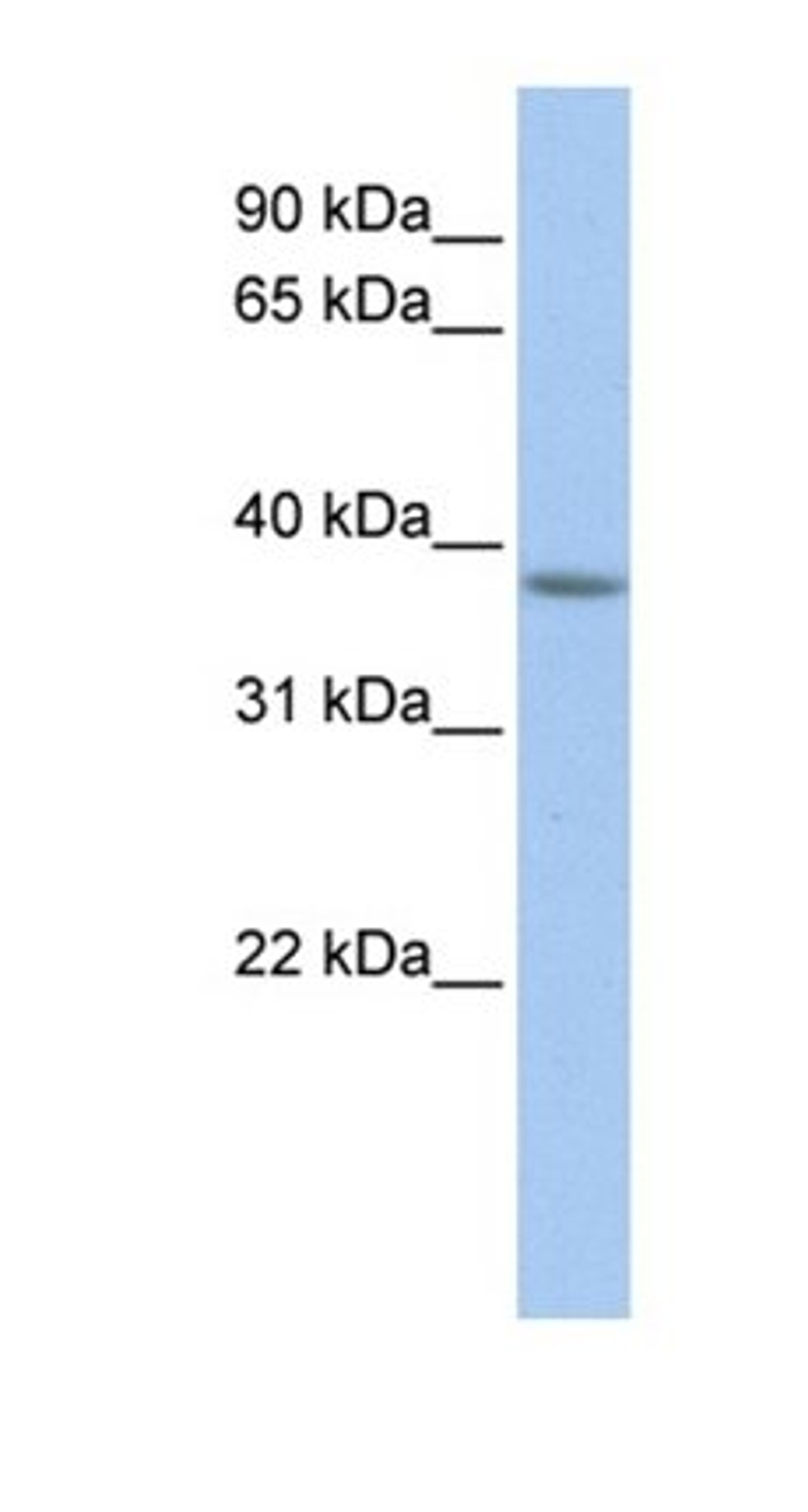 Western blot analysis of human Muscle tissue using MFF antibody